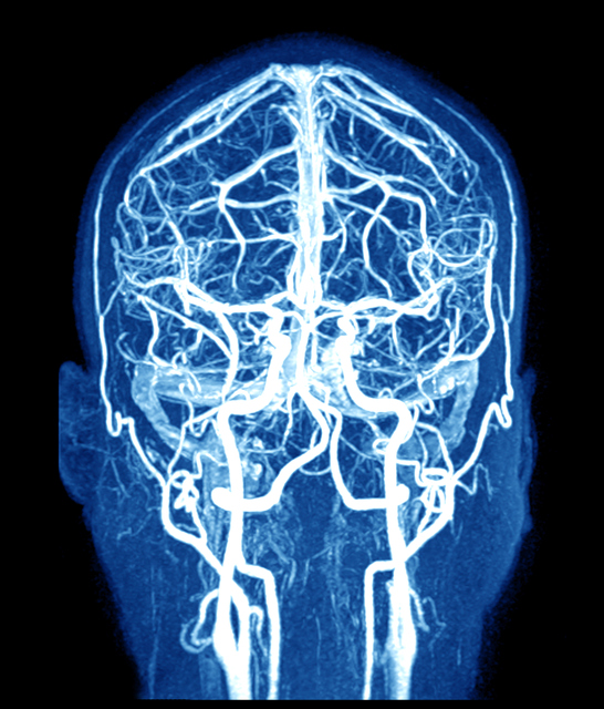 MRI of the brain and cerebral vessels