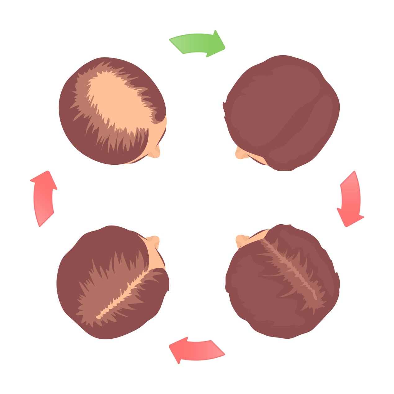 Hair loss cycle