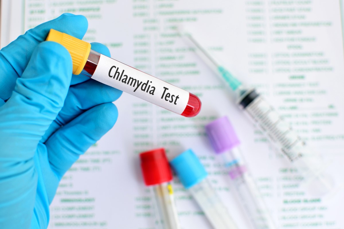 Chlamydia test - blood in test tube, gloved hand holding test tube, background of test tube, needle.