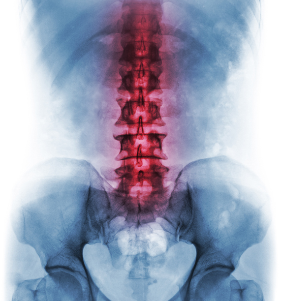 Spine model highlighted lower part