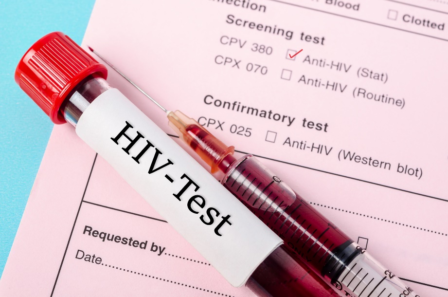 Diagnostic test for the presence of anti-HIV antibodies in a patient's blood sample
