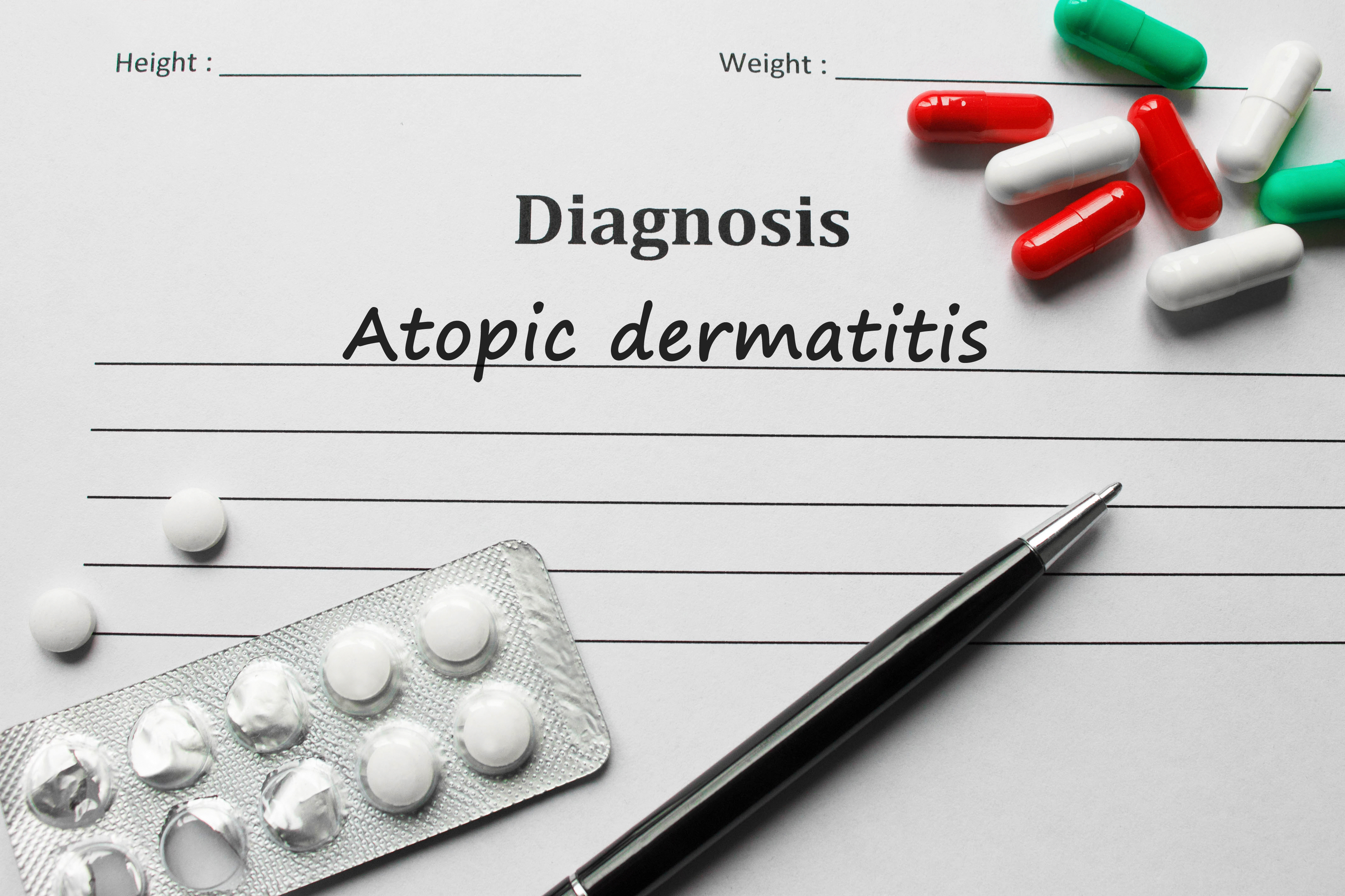 Diagnosis of atopic dermatitis