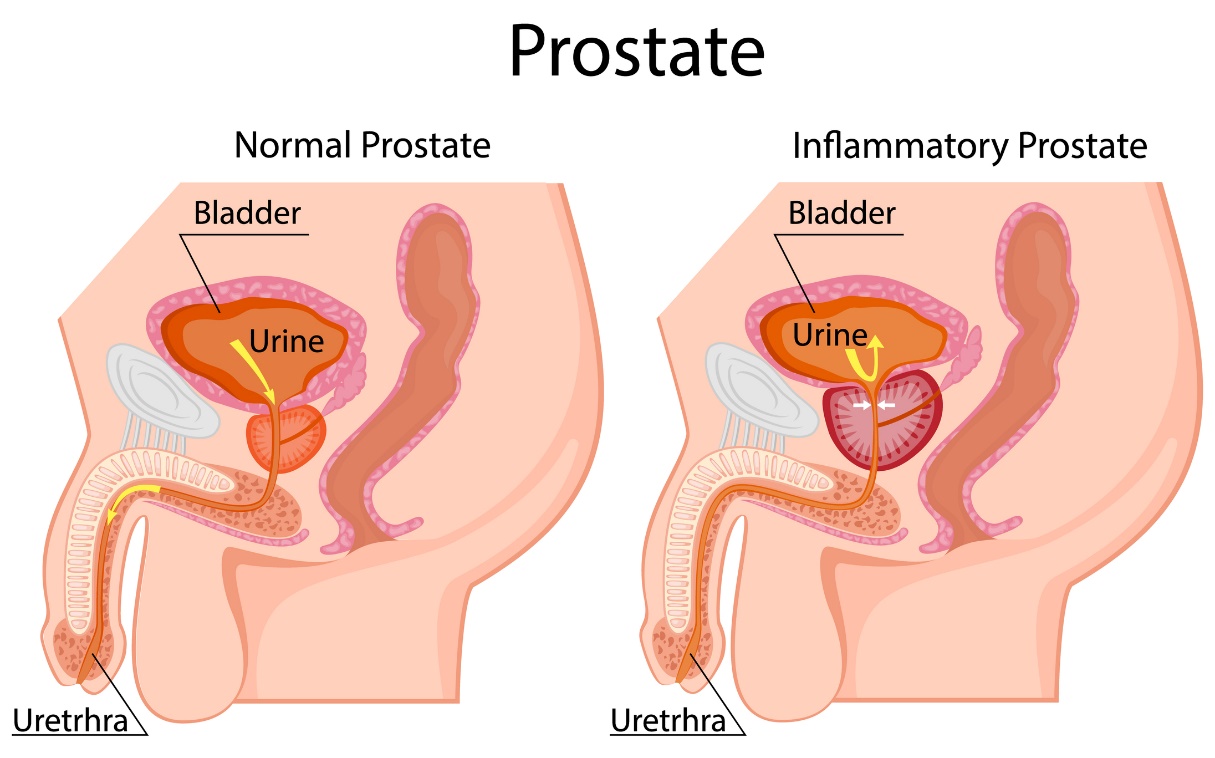 cross section of a male body, internal organs, bladder, prostate