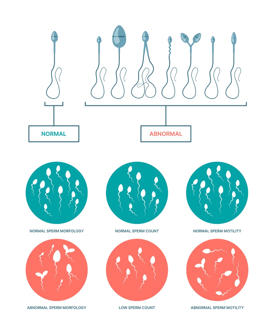 Physiological and abnormal condition of spermatozoa. Sperm morphology, number and motility