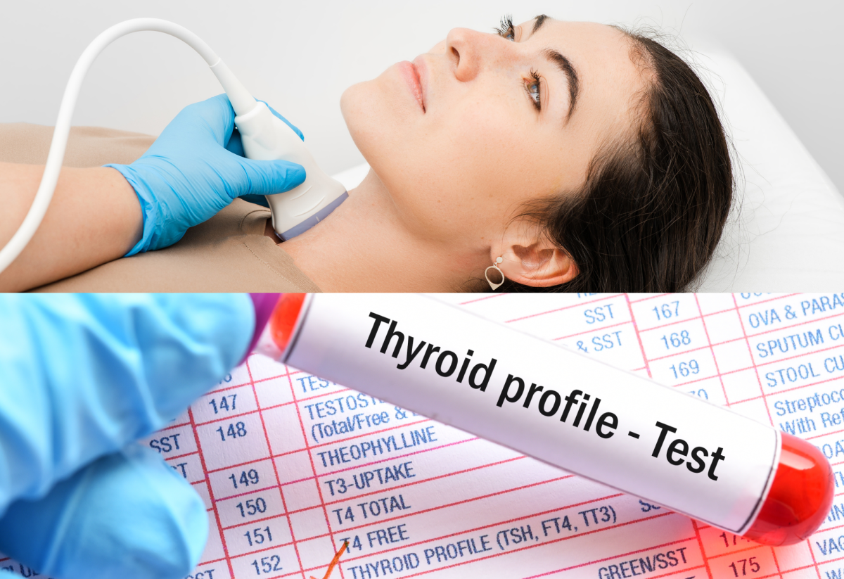 Thyroid examination - blood sampling and hormone levels and SONO/USG
