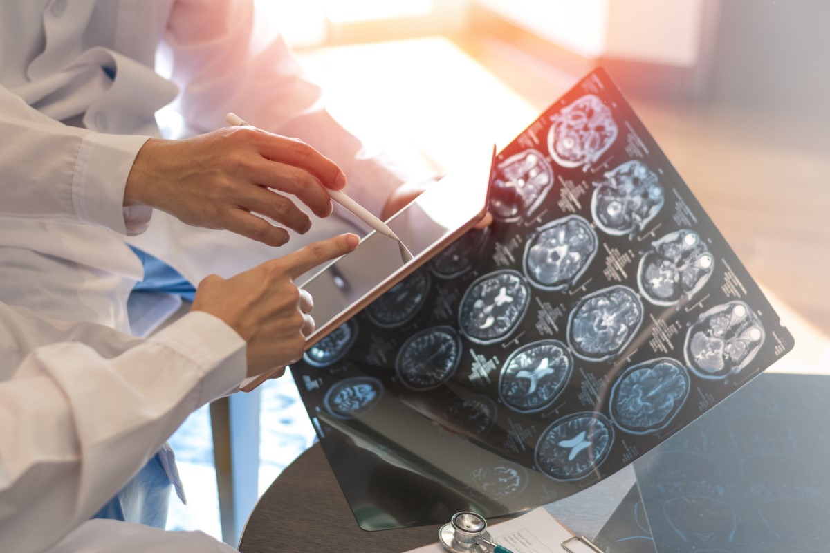 Brain scans, as the basis of the examination, the doctor holds the images in his hand, in the other he has a tablet, assesses the condition