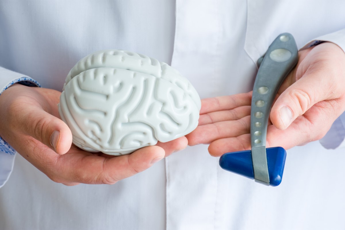 Examination by a neurologist, the doctor holds a model of the brain and a neurological examination hammer.