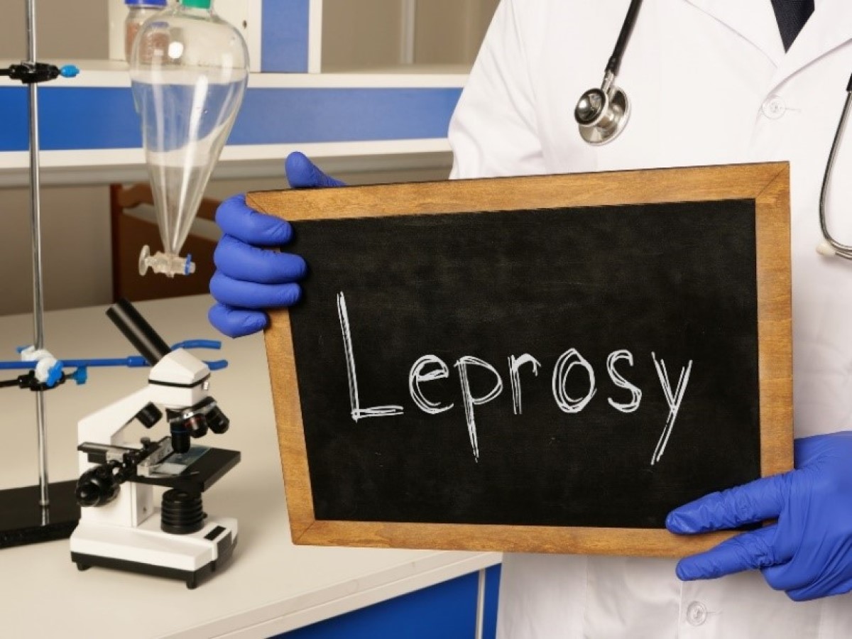 Leprosy: What is leprosy, how does it occur and what are its symptoms ...
