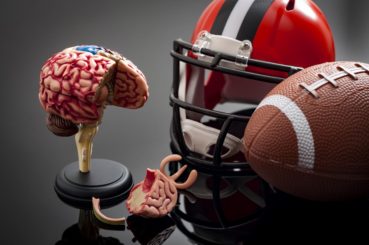 American football as a representative of sports with repetitive head injuries