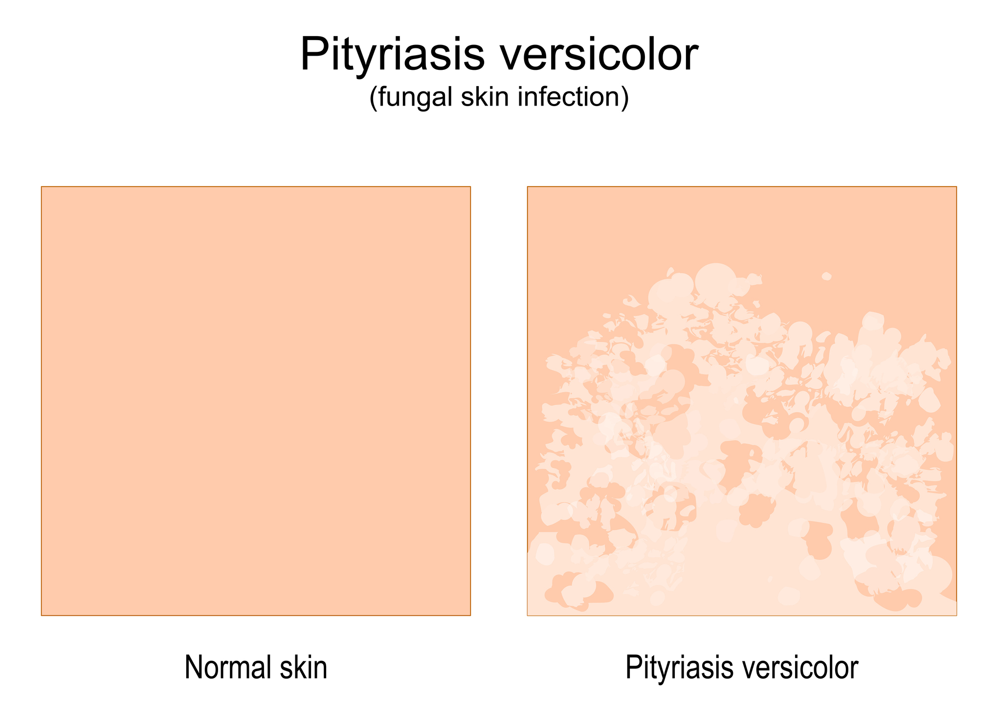 Comparison of normal skin and skin with signs of disease