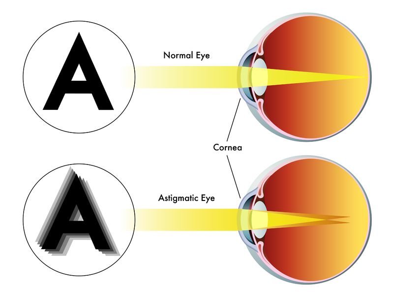 How the letter seen by the normal eye compared to the astigmatic eye