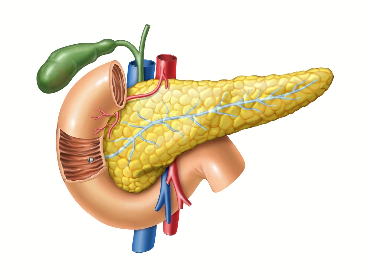 Pancreas - anatomical view, in addition, the pancreatic duct to the small intestine, gallbladder and large vessels are visible