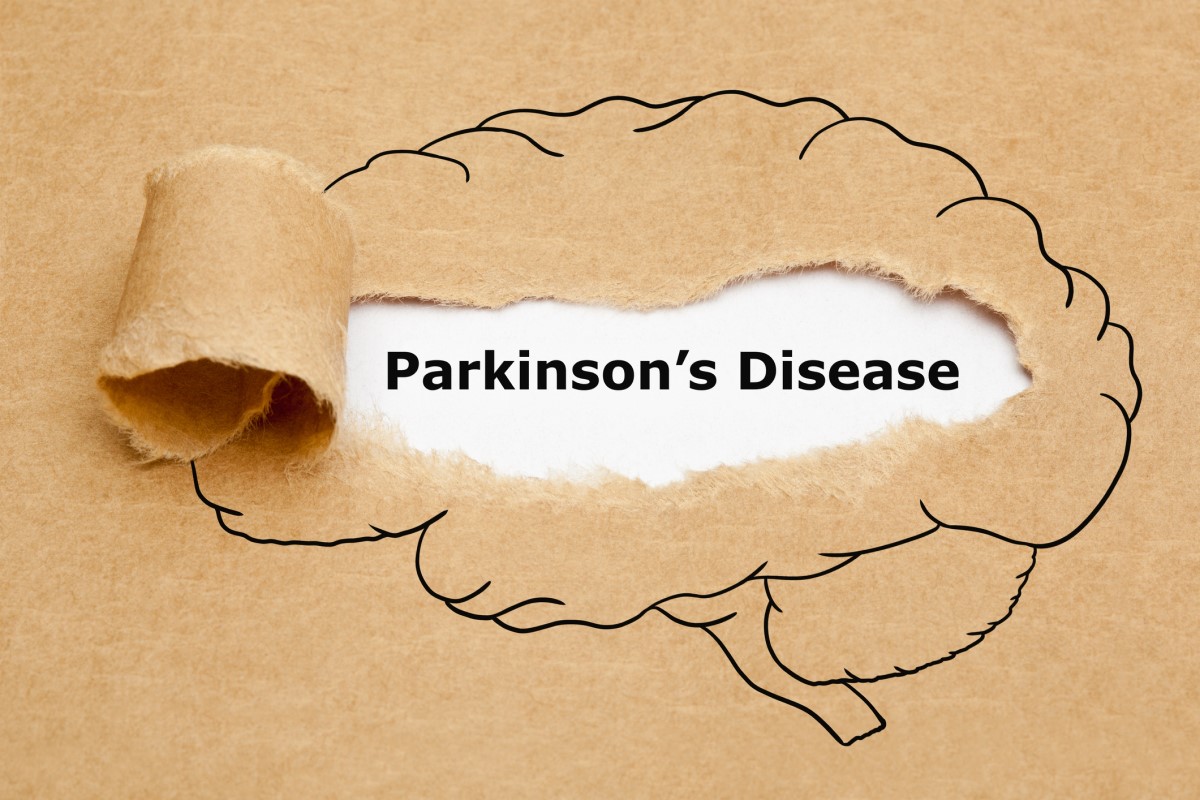 Morbus parkinson = Parkinsons disease = Parkinson's disease - animation of a brain with Parkinson's disease in the middle