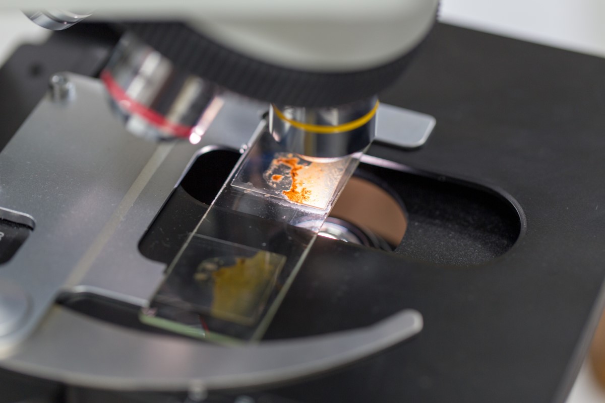 Microscopic diagnostics - stool on a slide