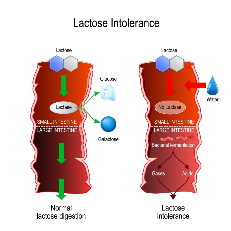 Comparison of physiological digestion and lactose intolerance