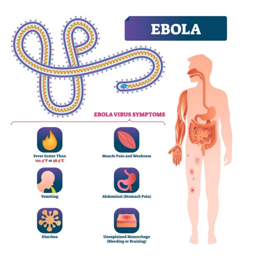 Symptoms of Ebola