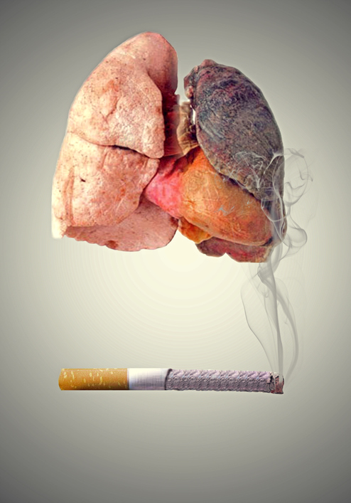 Lungs destroyed by smoking and cancer in a symbolic representation