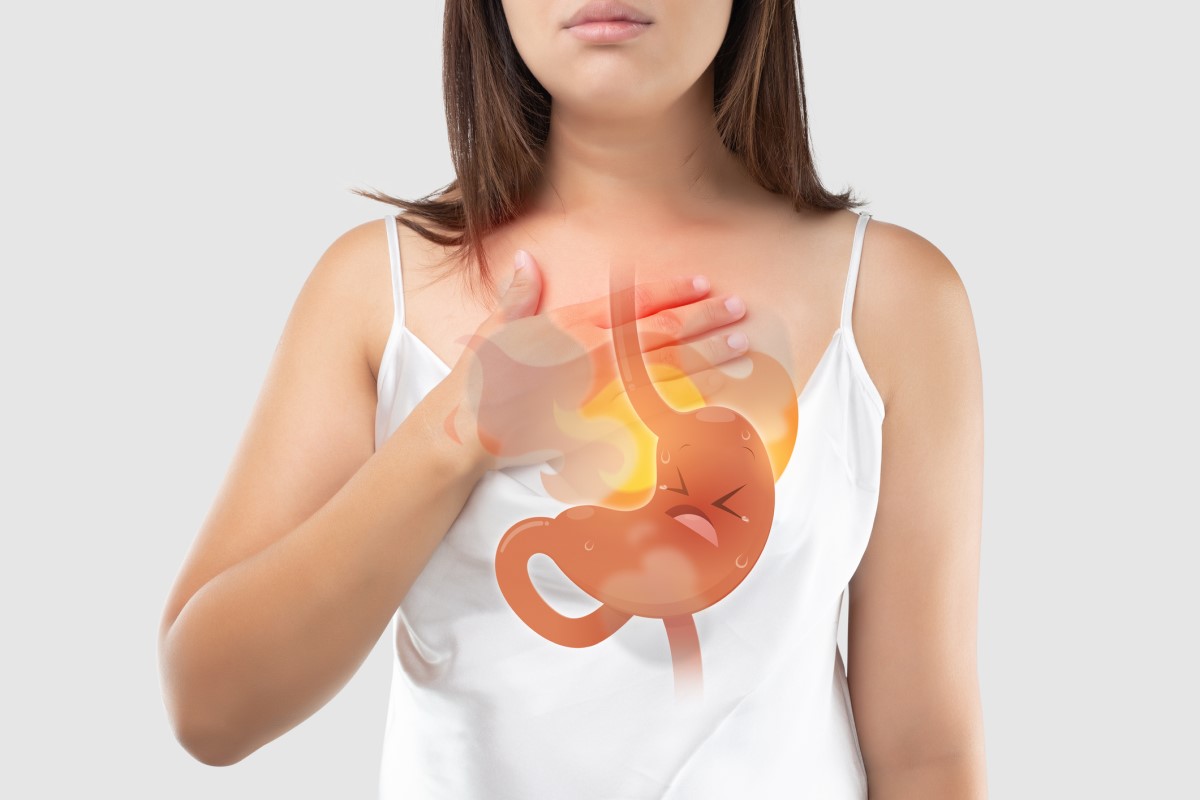A woman has chest pain in the form of a burning sensation behind the sternum that radiates from the stomach, depicting stomach and reflux difficulties