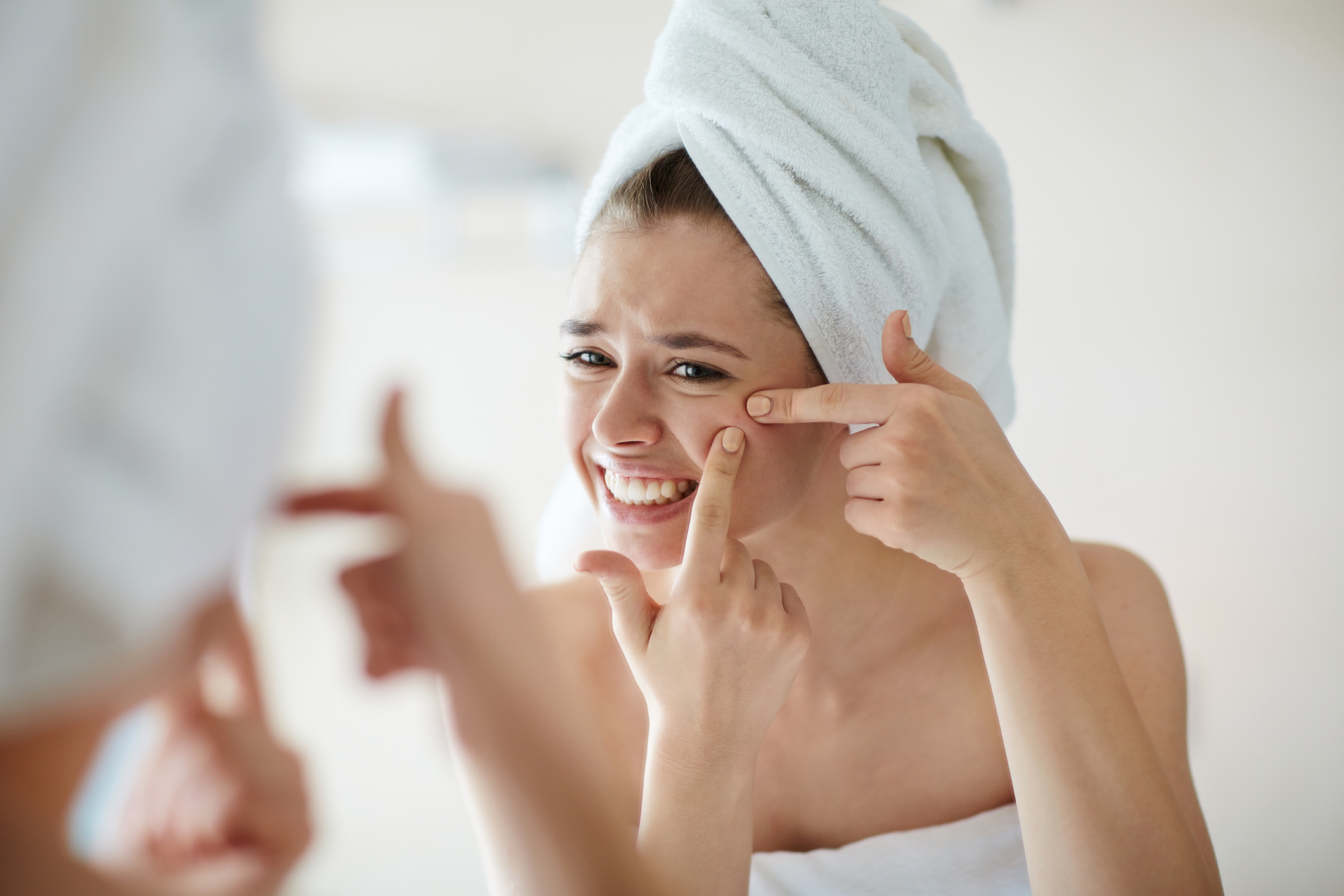 A woman with acne on her face, squeezing out her pimples, has a towel on her hair.