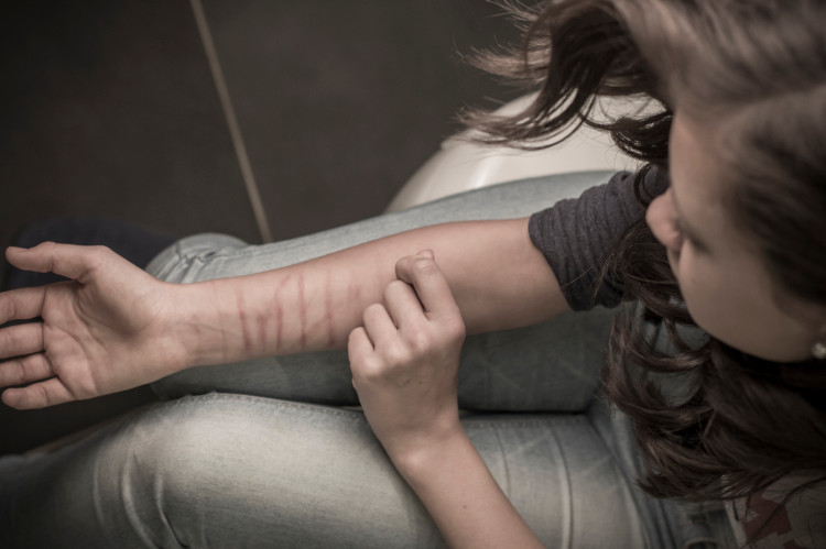 a young woman cuts her forearm with a sharp object