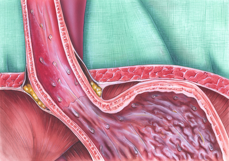 anatomically depicted sphincter on the oesophagus