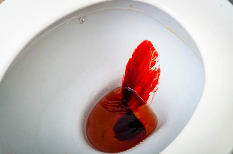 fresh blood in the white toilet bowl
