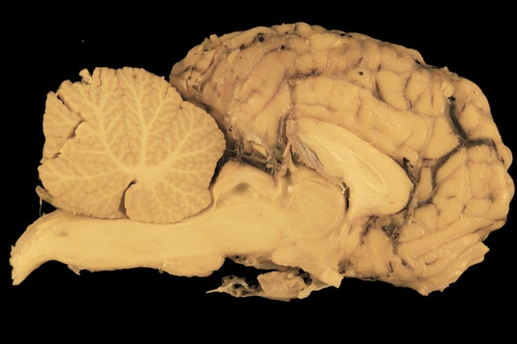 cross-section of brain tissue