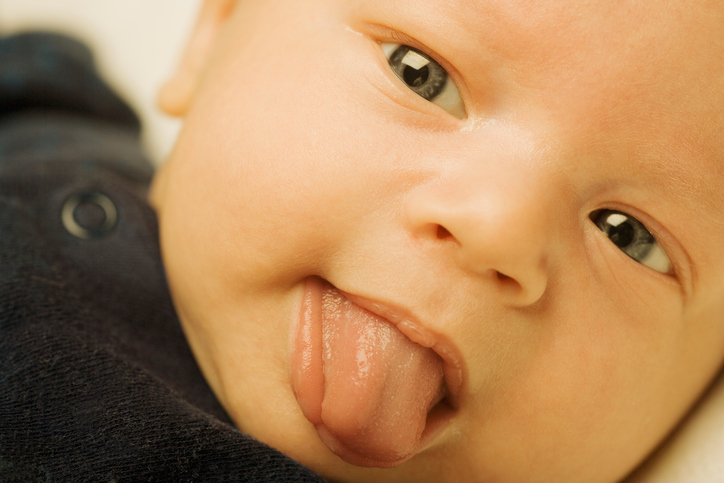 child with jaundice crawling tongue