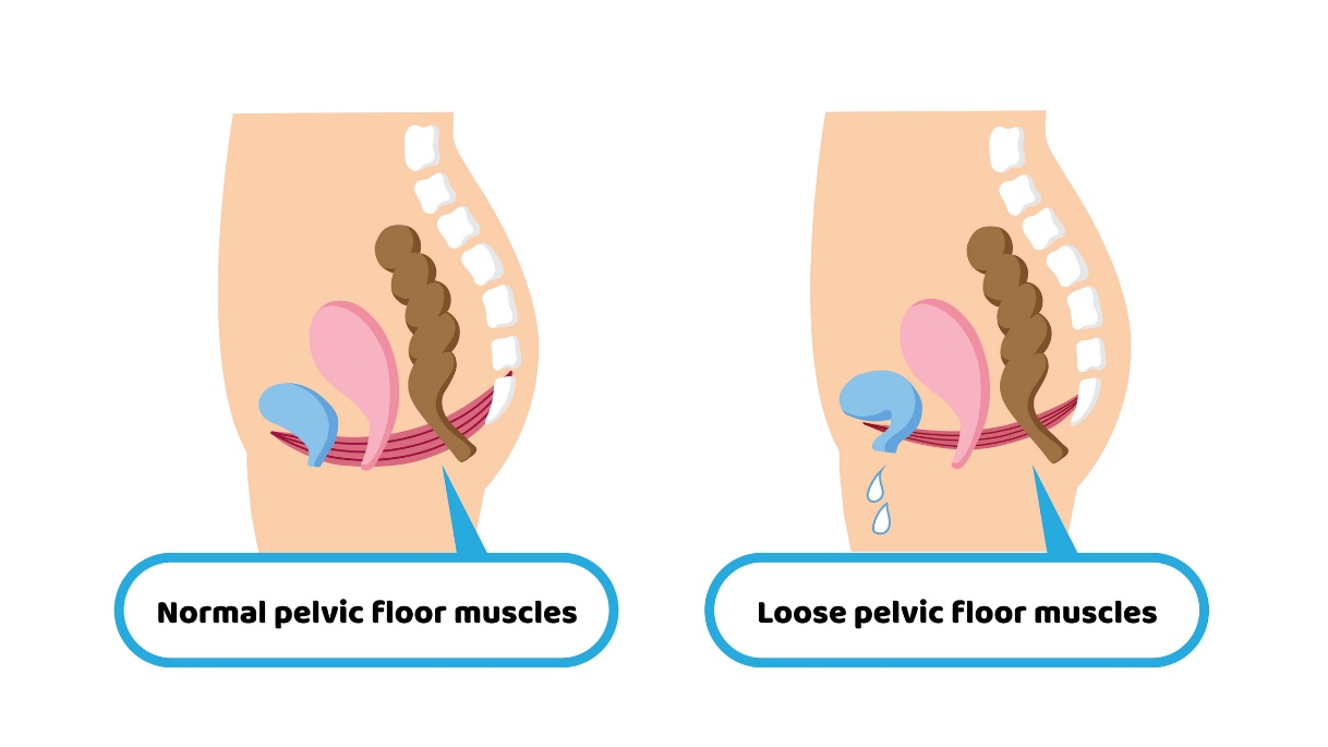 Pelvic floor muscle physiology and pelvic floor muscle weakness