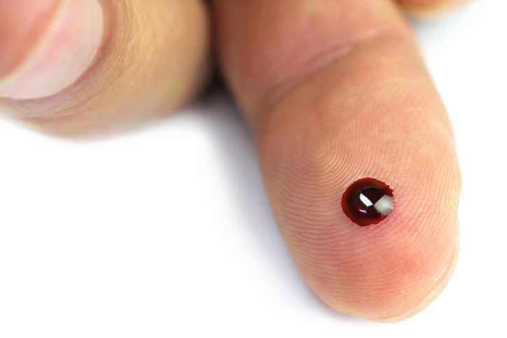 Glycaemia - a drop of blood on the belly of the finger after a needle prick to measure blood sugar