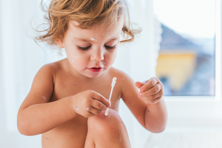 A naked child treats her skin with a cotton swab