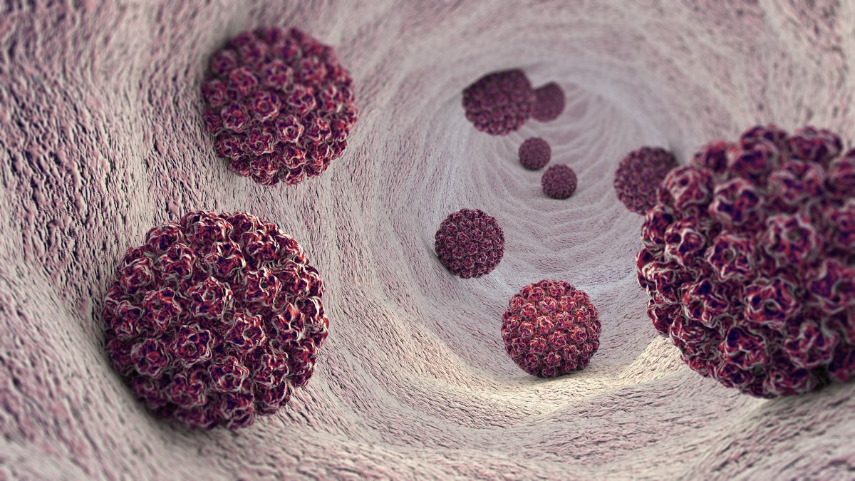 HPV - human papillomavirus