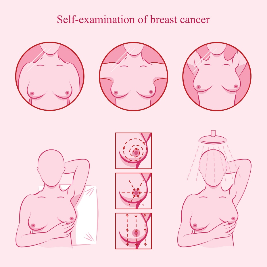 Illustration of breast self-examination