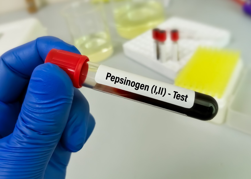 Blood sample for laboratory testing of pepsinogen levels and gastro disease