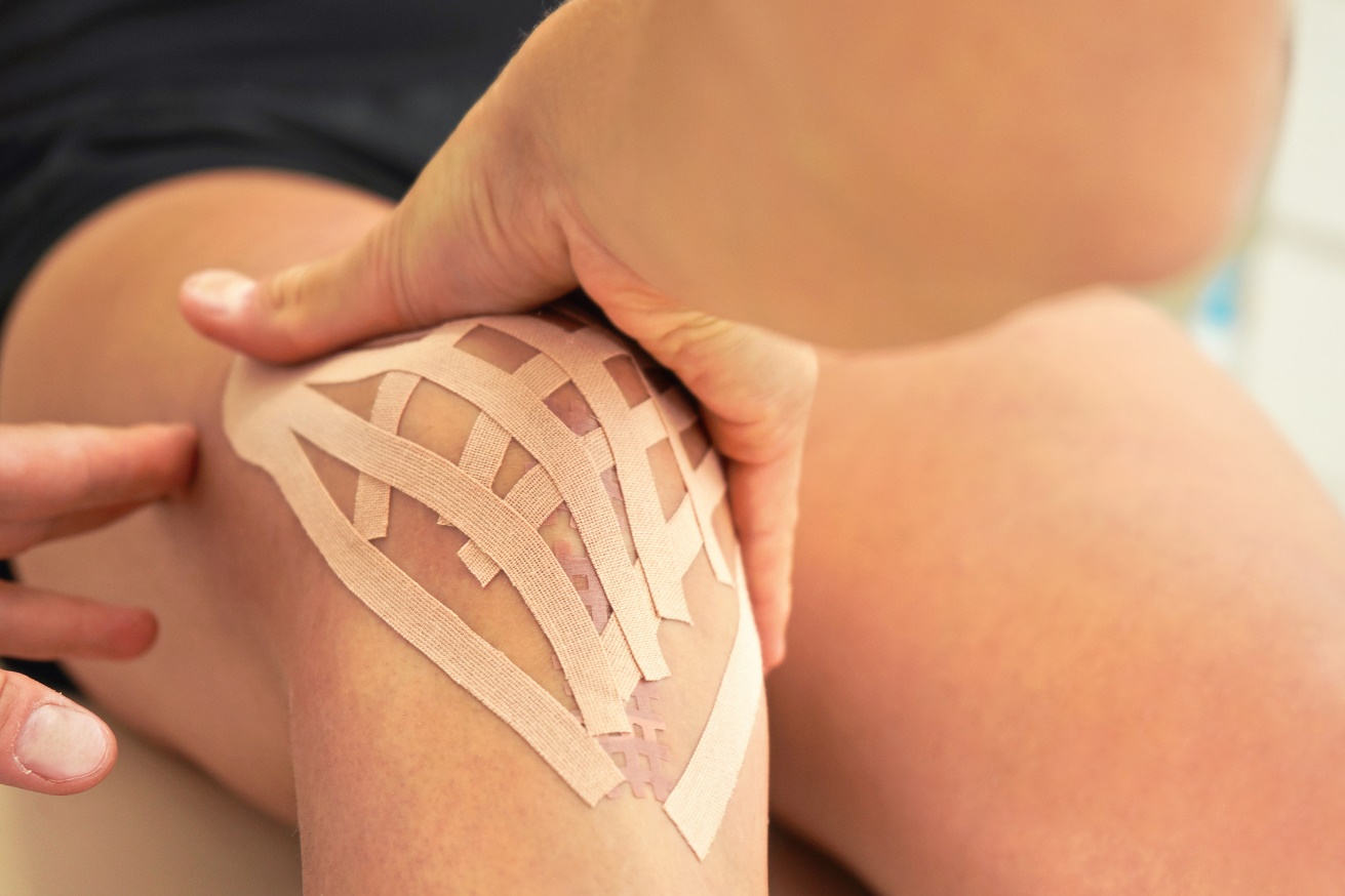 Lymphatic kinesiotaping (lymphotape) applied in the knee joint area