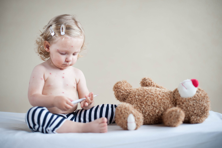 a child with measles plays with a teddy bear