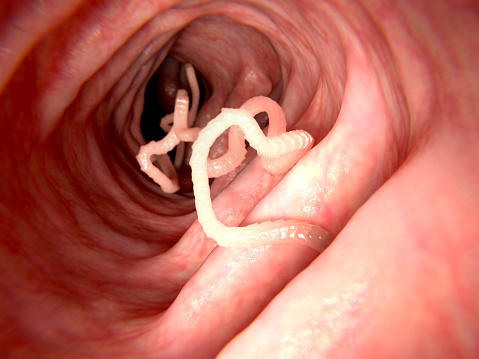 parasite inside an organ