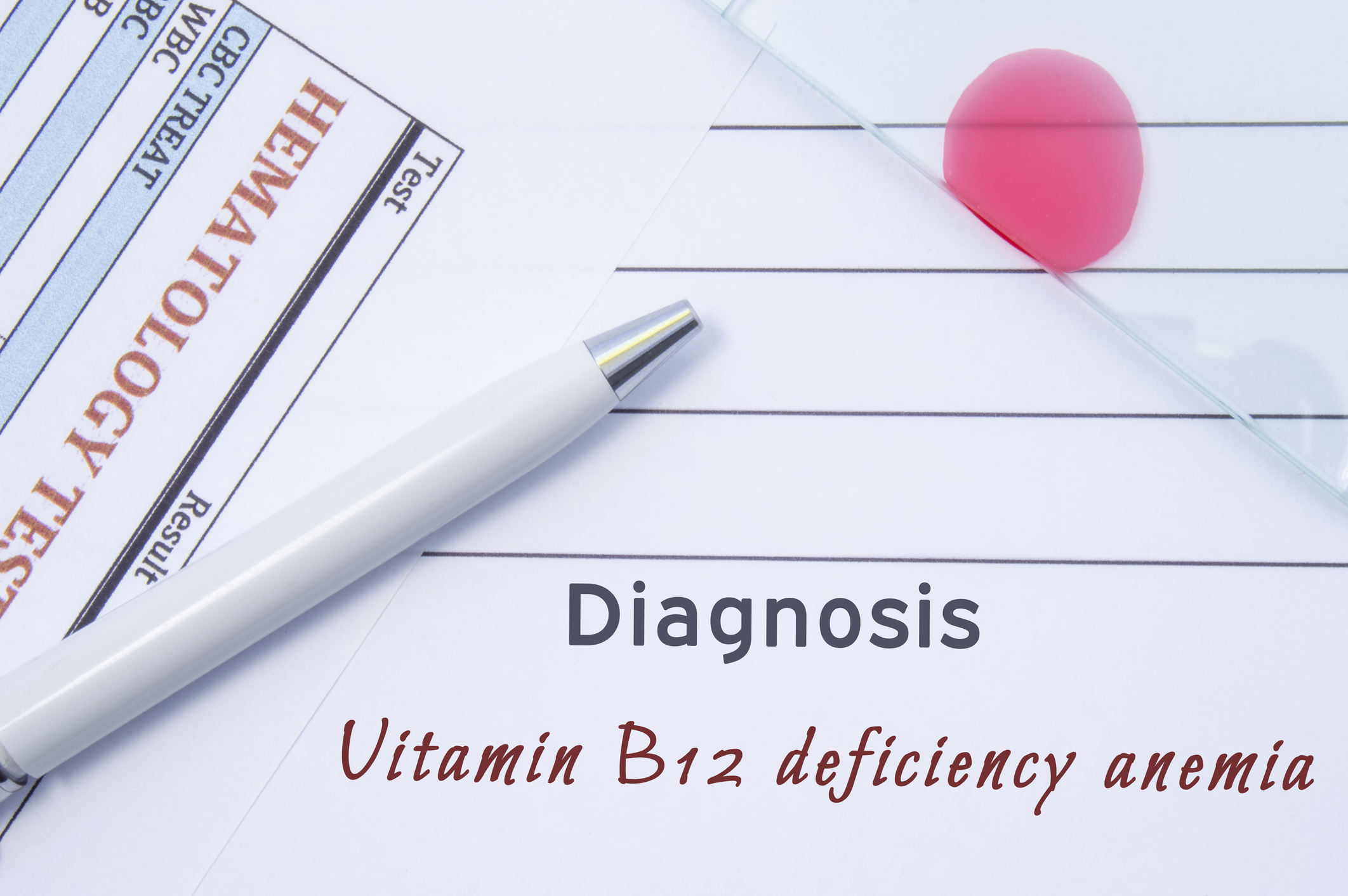 Vitamin B12 deficiency can cause pernicious anemia.