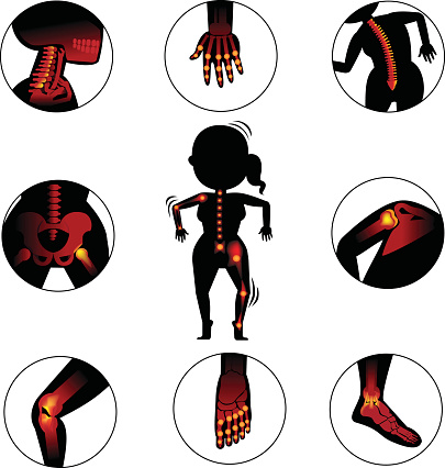 human silhouette with details of affected joints