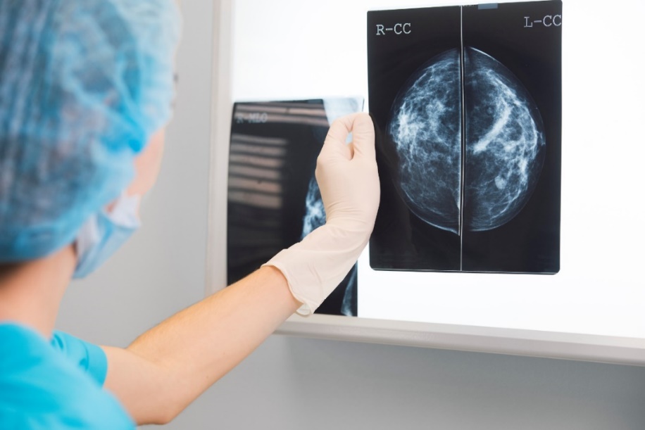 Mammogram of the breast