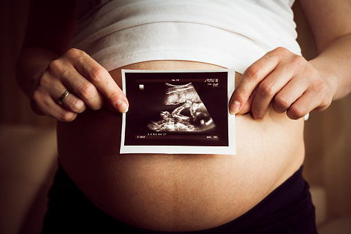 Pregnant woman holding a sonogram with a picture of a baby