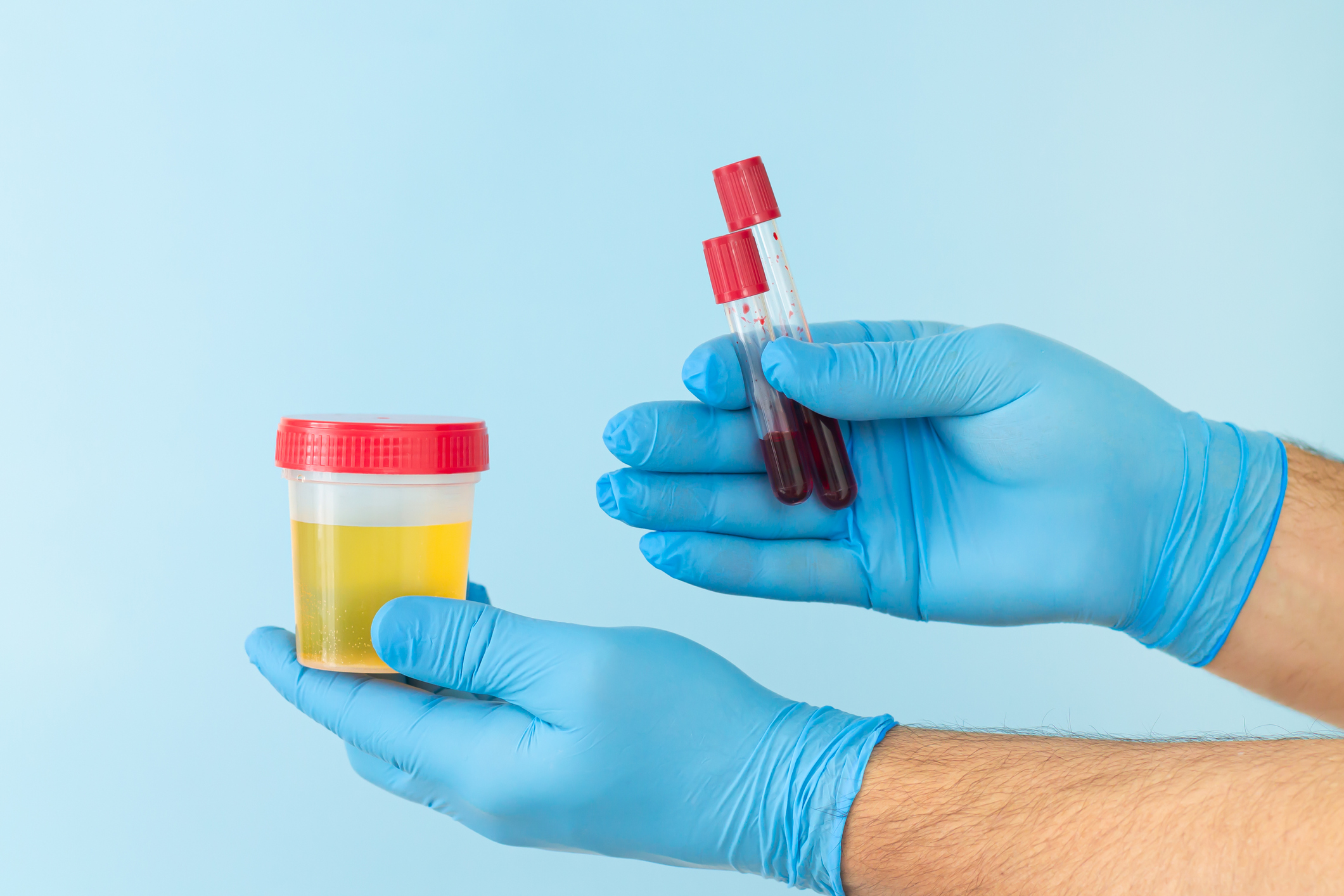 Deviations from physiological blood or urine chloride levels are detected by laboratory tests.