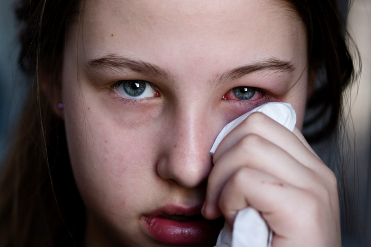 the girl has inflammation of the eye, swelling of the eye, redness of the eye, hand, handkerchief 