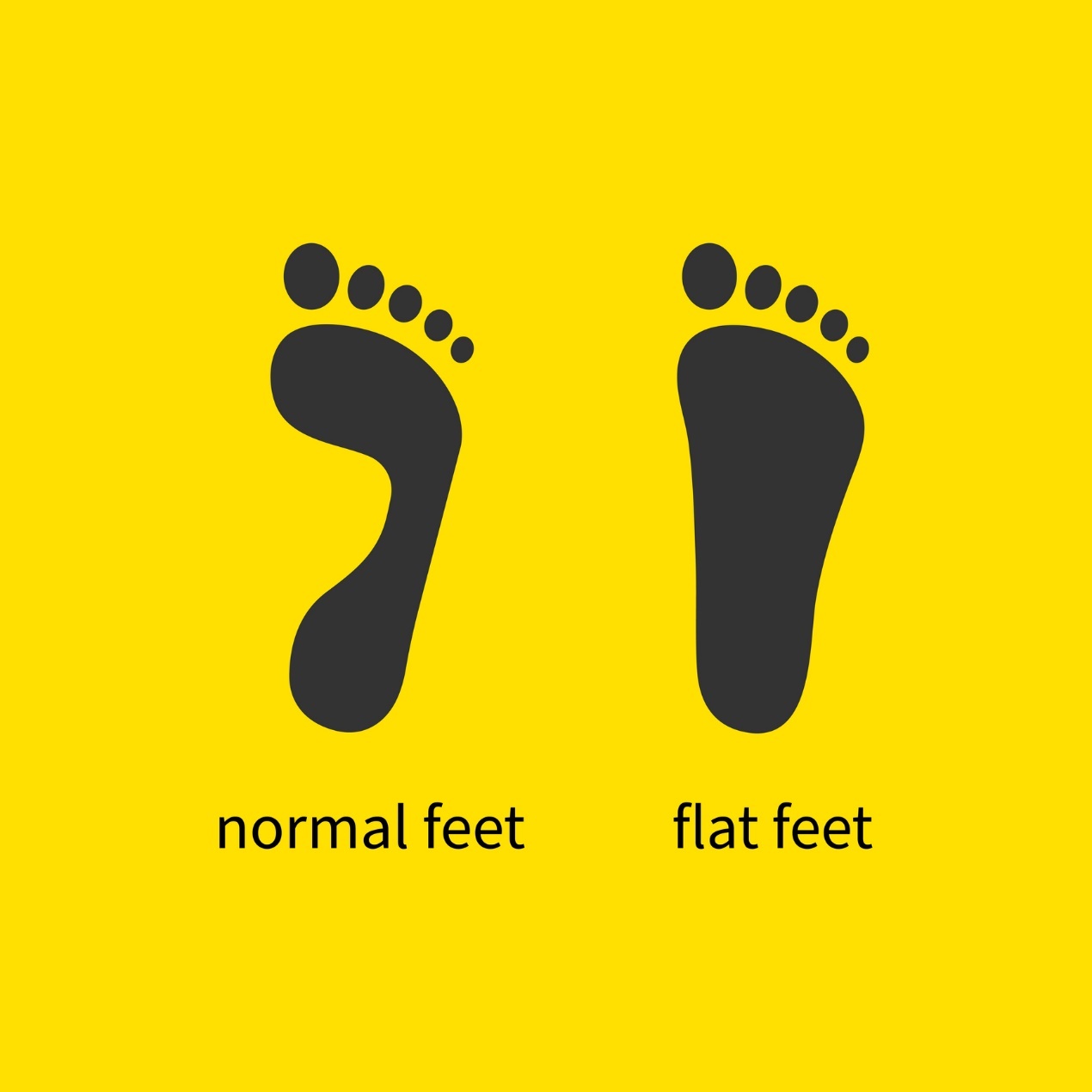 Difference between flat and normal foot