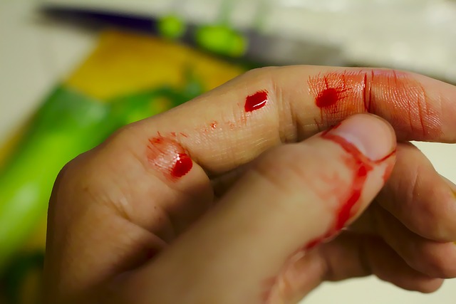 Hand, blood, bleeding, injury