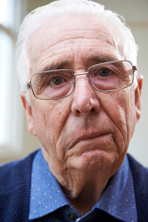 An elderly man has paresis of the facial nerve, i.e. the facial nerve, in both peripheral cause and stroke