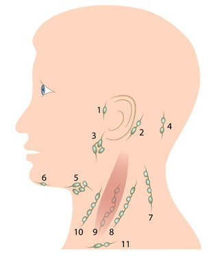 Nodules of the head and neck