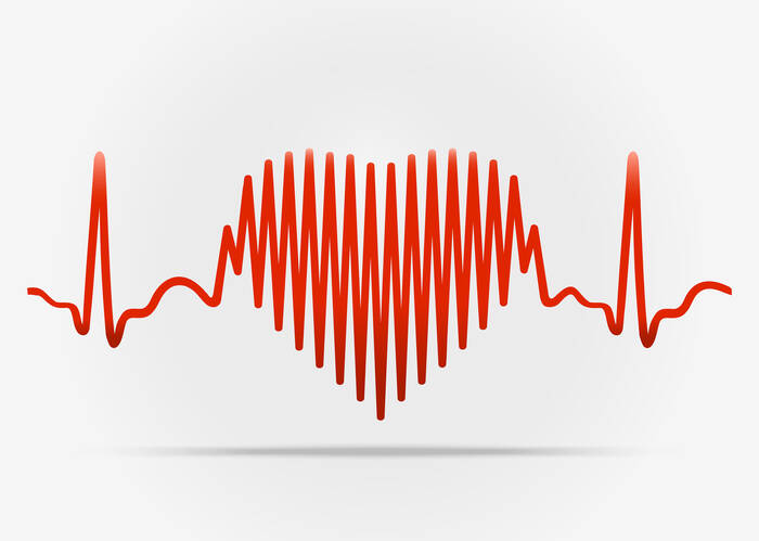 Arrhythmia: What is a cardiac arrhythmia and how is it manifested? + Treatment