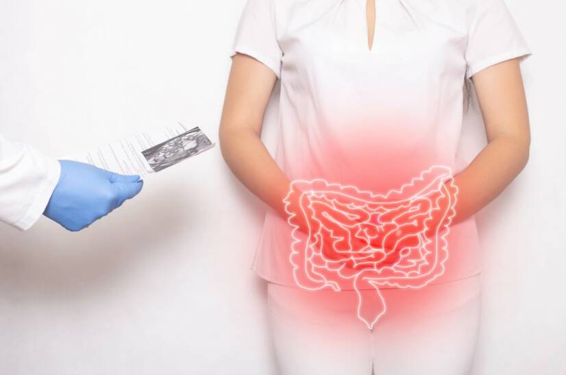 Crohn's disease: what is it, why does it occur and what are its symptoms?