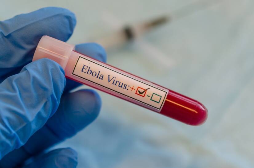 Ebola: What are the symptoms?